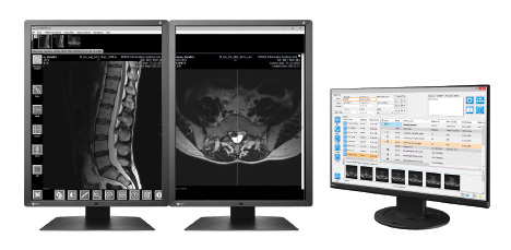 Przeglądarka DICOM - IQ VIEW PRO (licencja roczna)